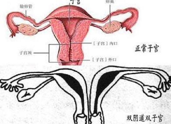 帶你了解什么是縱膈子宮，別再和雙子宮搞混了