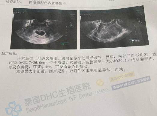 泰國(guó)DHC好孕檔案0919：從攻克46%精子碎片率，到見(jiàn)證7周健康心跳