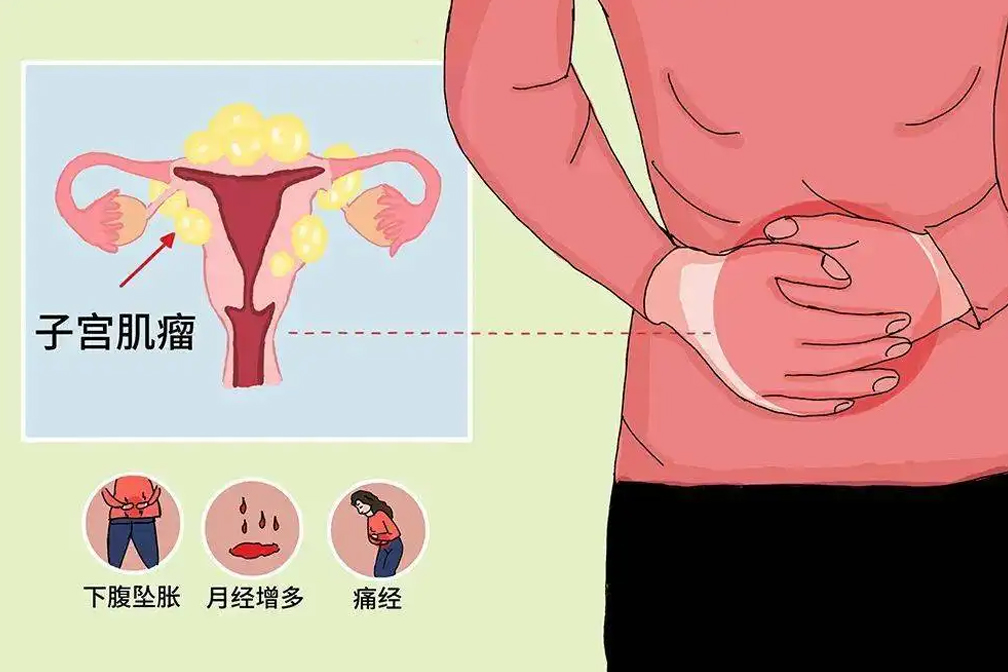 月經(jīng)不調(diào)做試管如何開(kāi)展周期，注意事項(xiàng)有哪些？
