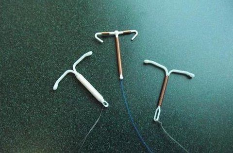 節(jié)育器有幾種類(lèi)型哪種最好？節(jié)育器的種類(lèi)和優(yōu)缺點(diǎn)