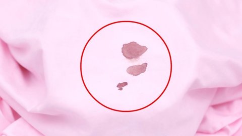 怎樣去除血漬比較干凈？去除血漬的小妙招