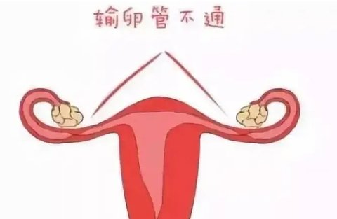 輸卵管有問題是不是很難懷孕？輸卵管問題對懷孕的影響