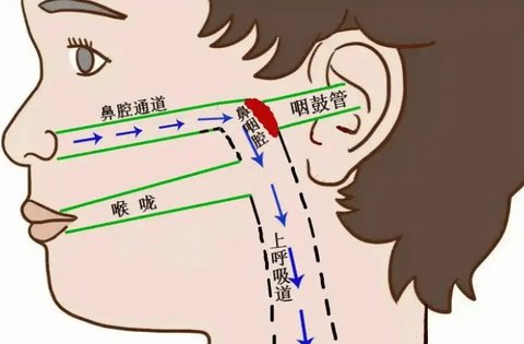 咽鼓管堵塞怎么疏通？咽鼓管堵塞自愈方法
