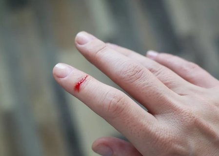 破傷風(fēng)早期有哪些癥狀？破傷風(fēng)早期的6個征兆