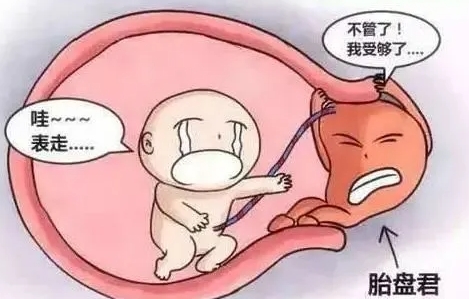 胎盤早剝是什么原因造成的？胎盤早剝的原因和癥狀