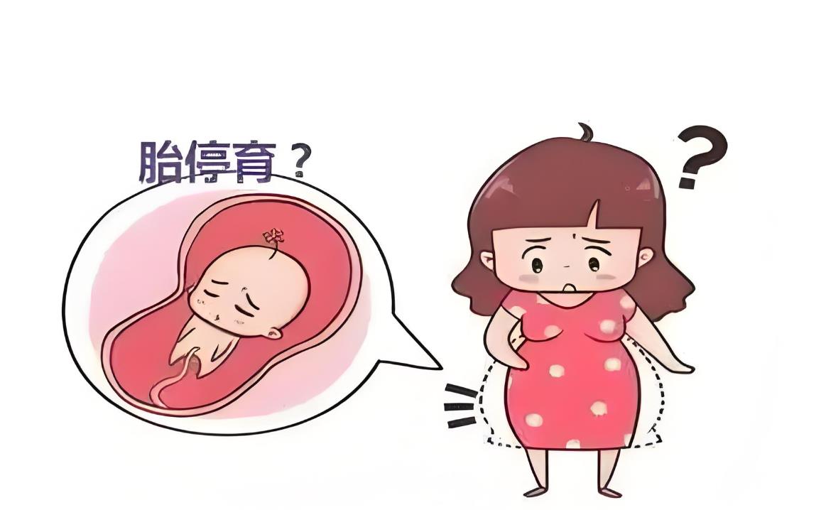 胎停 胎停