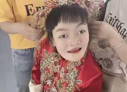 腦癱女孩嫁唐氏丈夫！問題父母能否生出健康孩子？