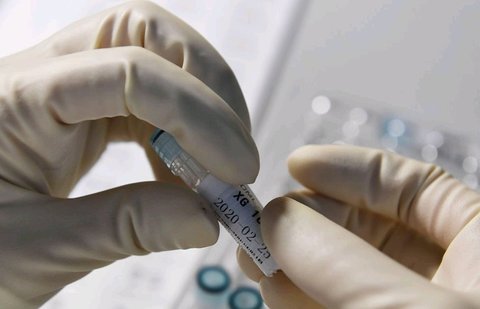 脂聯(lián)素偏低是什么原因怎么調(diào)理？調(diào)理策略分析