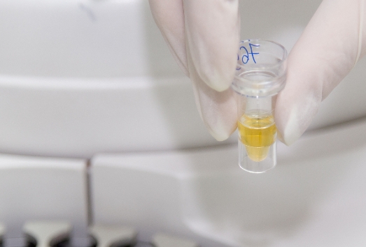 重慶試管嬰兒費(fèi)用大約多少？2025重慶費(fèi)用分析