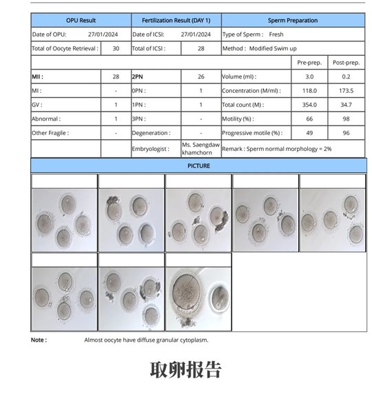 從絕望到希望：多囊卵巢患者6年艱辛求子，終在DHC圓滿(mǎn)！